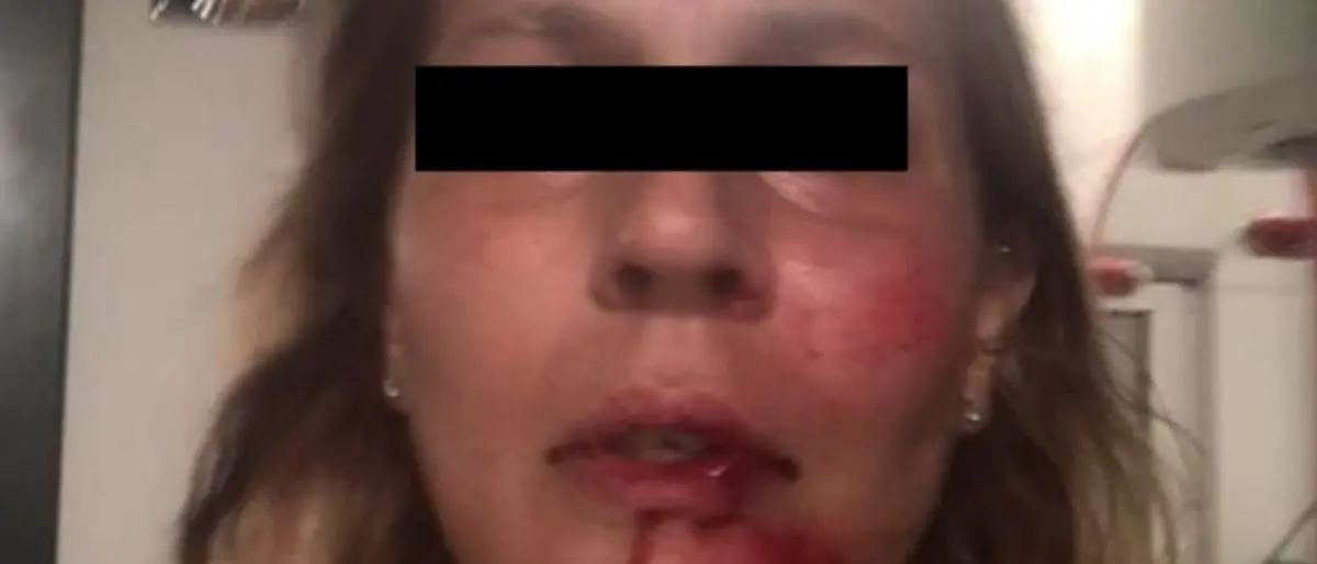 Tortora, una donna è stata aggredita brutalmente da 4 persone