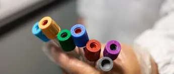 Covid Friuli Venezia Giulia oggi, 68 contagi: bollettino 19 agosto