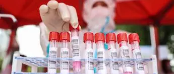 Covid oggi Liguria, 212 contagi: bollettino 19 agosto