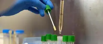 Covid oggi Sardegna, 403 contagi e 4 morti: bollettino 20 agosto