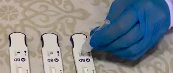 Covid oggi Lazio, 661 contagi e 7 morti: bollettino 20 agosto