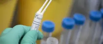 Variante Delta, sintomi e covid: rischio ricovero raddoppia