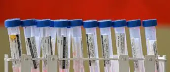 Covid oggi Toscana, 528 contagi: bollettino 29 agosto