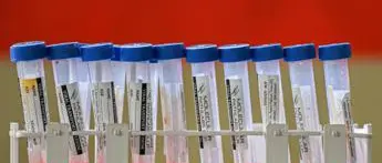 Covid oggi Sicilia, 1.155 contagi e 27 morti: bollettino 1 settembre