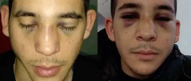 Studente del Paraguay aggredito, ecco chi sono gli autori del pestaggio