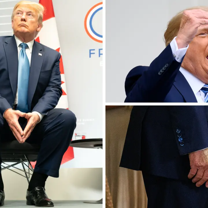 Caviglie gonfie e lividi sulle mani, il web s’interroga sulla salute di Trump e la Casa Bianca rassicura: «Nessun mistero»