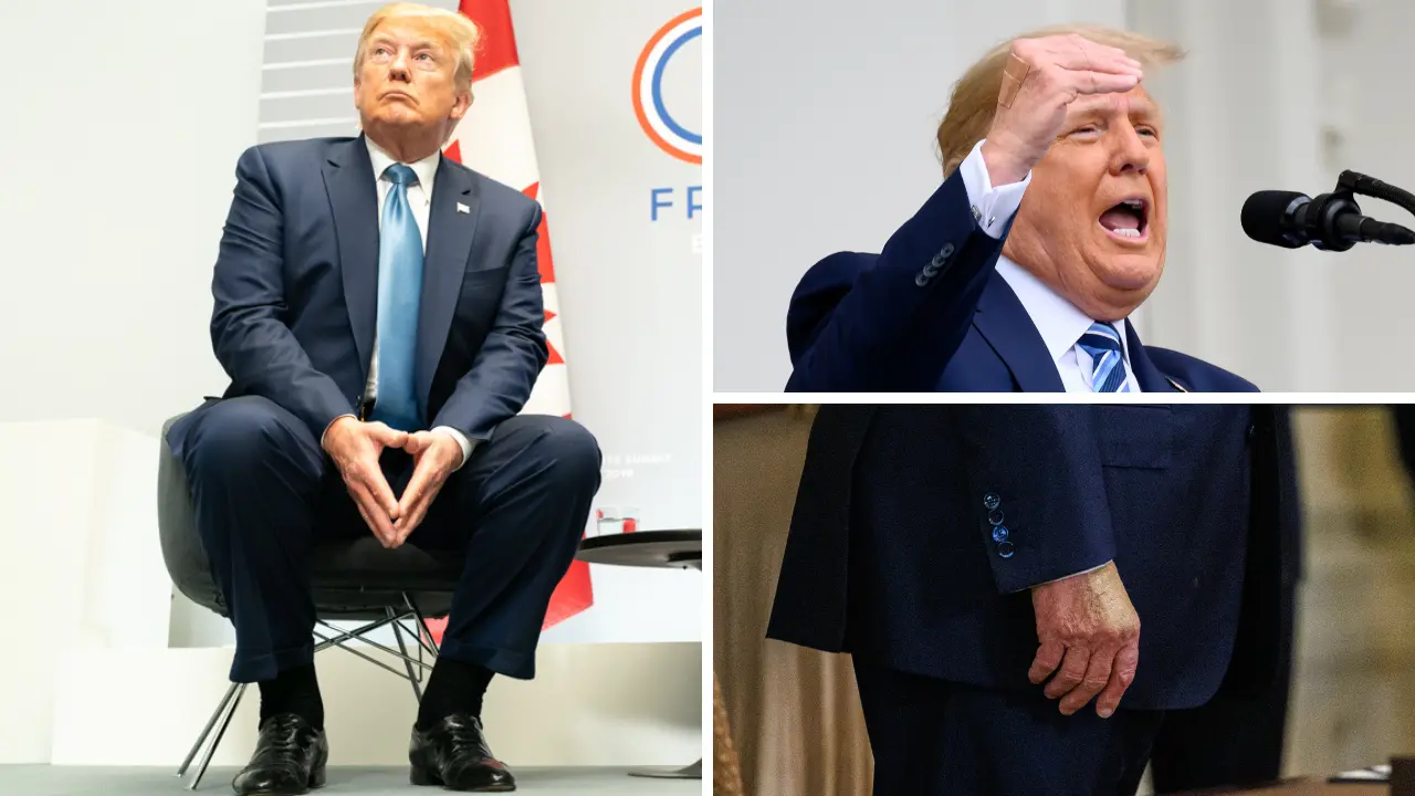 Caviglie gonfie e lividi sulle mani, il web s’interroga sulla salute di Trump e la Casa Bianca rassicura: «Nessun mistero»