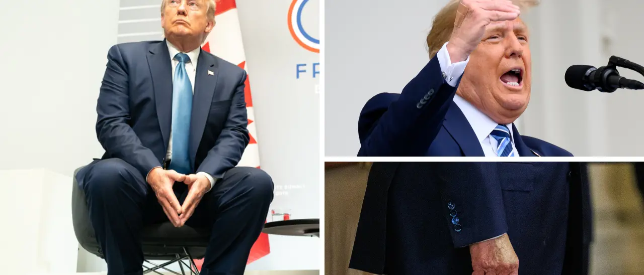 Caviglie gonfie e lividi sulle mani, il web s’interroga sulla salute di Trump e la Casa Bianca rassicura: «Nessun mistero»