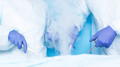 Two surgeons of Hiurge do surgery using liquid nitrogen cryotherapy to remove malignant tumors, tumors. Modern method of treatment cryosurgery, hemorrhoids , Shutterstock