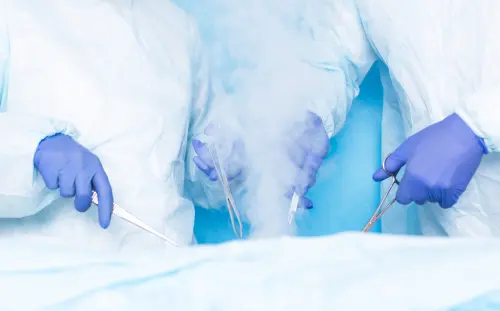 Tumori benigni congelati e distrutti: ecco cos’è la crioterapia