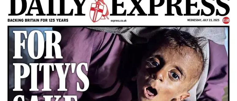 Il bimbo di Gaza come uno scheletro: l’immagine di Muhammad sciocca il mondo\n