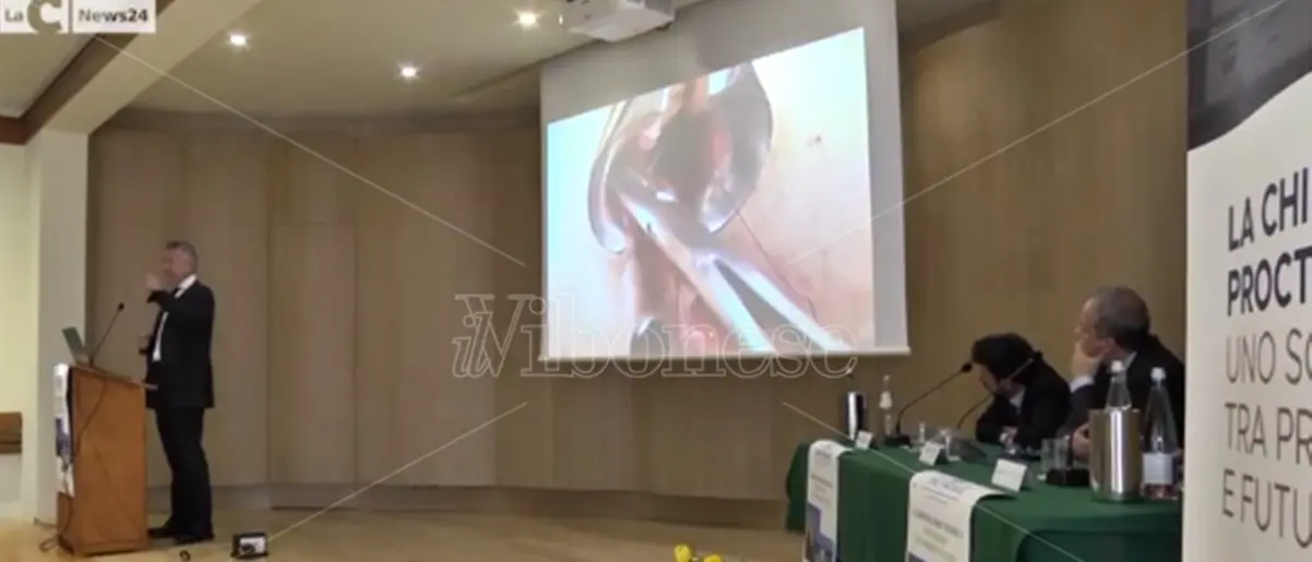 Proctologia, a Vibo specialisti da tutta Italia a confronto su passato e presente -Video