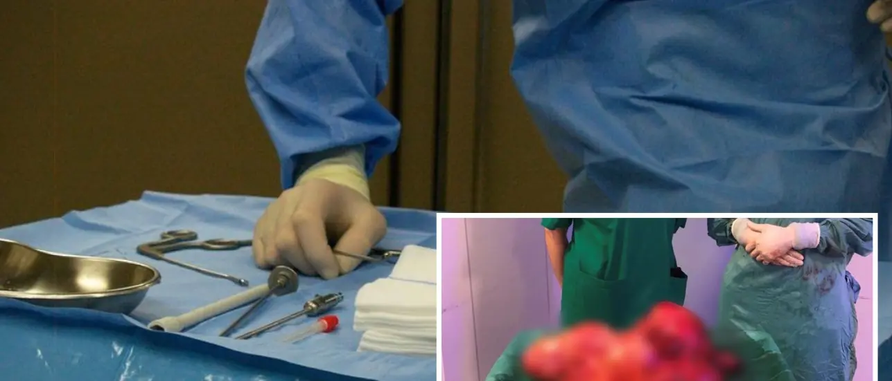 Intervento record a Cosenza, l'equipe del vibonese Bruno Nardo asporta tumore di 7,5 Kg