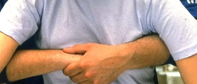 Manovra di Heimlich provvidenziale, poliziotto salva commessa