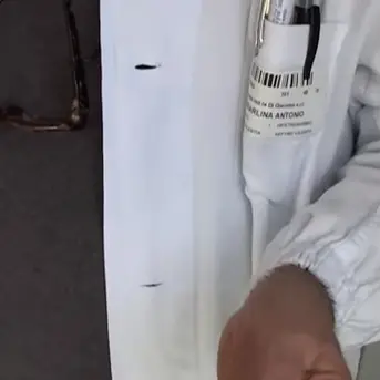 Bimbo nato morto, parla il primario: «Complicanza non diagnosticabile»