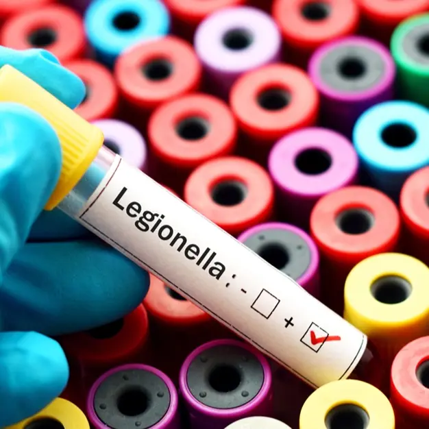 Caso di Legionella alla Scuola Allievi Carabinieri di Reggio, UNARMA: «Massima trasparenza e controlli puntuali»\n