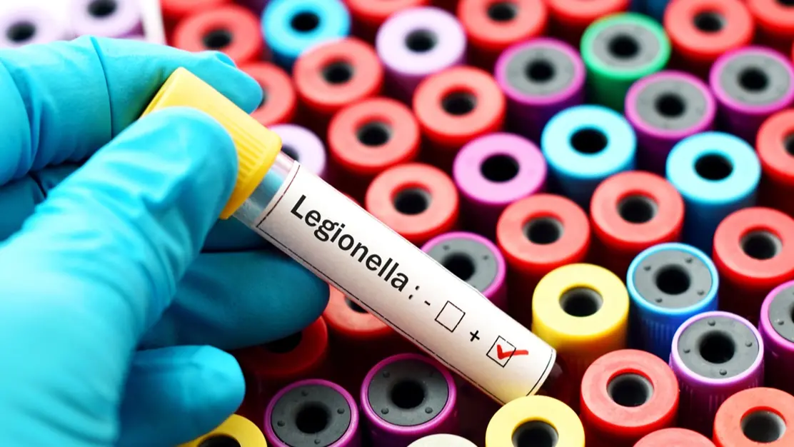 Caso di Legionella alla Scuola Allievi Carabinieri di Reggio, UNARMA: «Massima trasparenza e controlli puntuali»\n