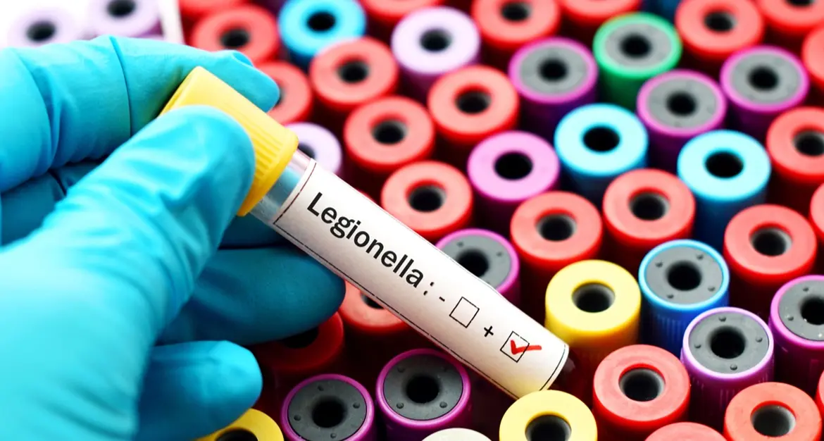 Caso di Legionella alla Scuola Allievi Carabinieri di Reggio, UNARMA: «Massima trasparenza e controlli puntuali»\n