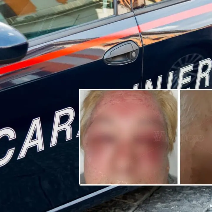 Brutale pestaggio a Vibo Marina: vittime due anziani colpiti in casa per dissidi con i vicini