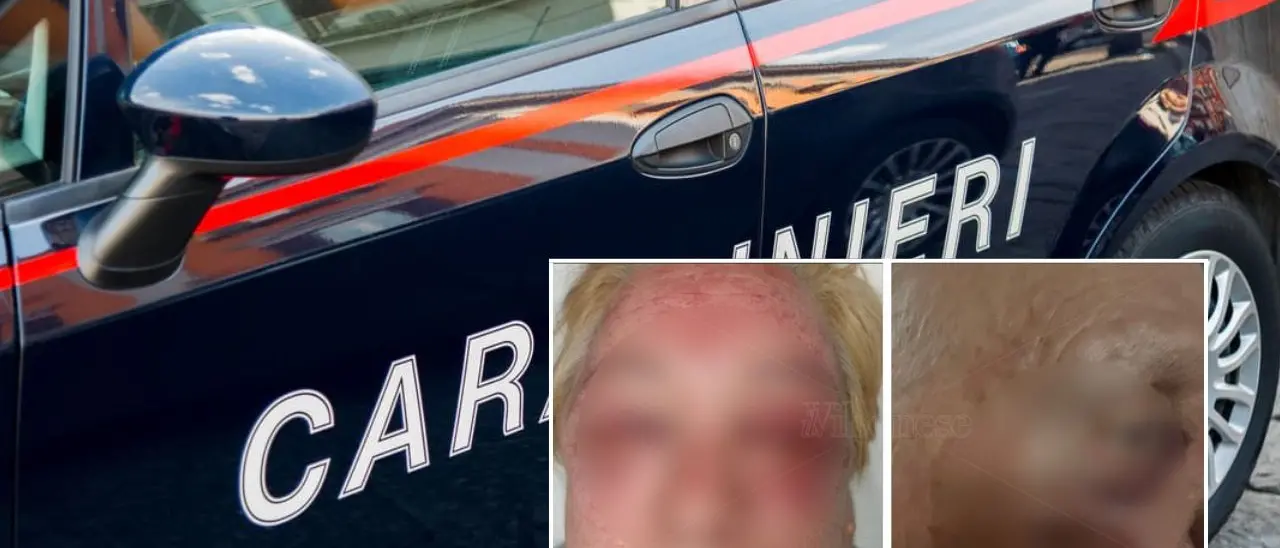 Brutale pestaggio a Vibo Marina: vittime due anziani colpiti in casa per dissidi con i vicini