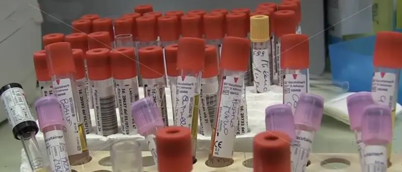 Covid, nel bollettino dell’ospedale Pugliese altri 32 casi riferiti a Vibo