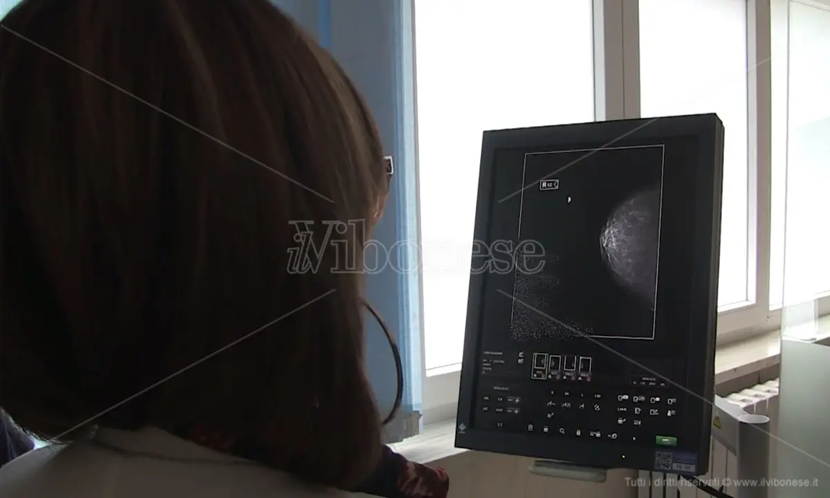Tumori al seno: riparte a Vibo Valentia lo screening mammografico gratuito - Video