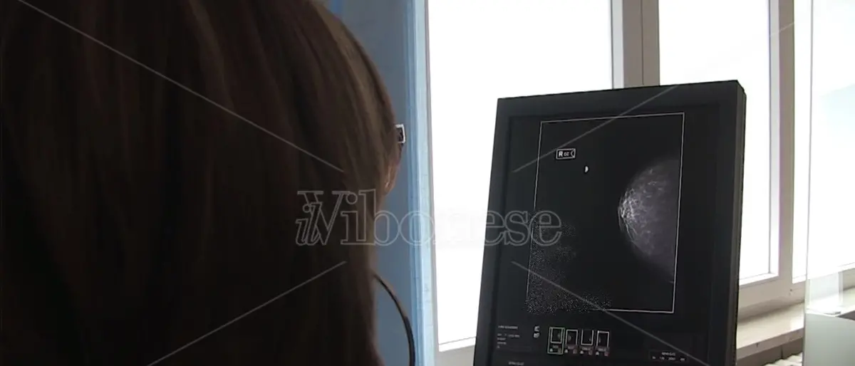 Tumori al seno: riparte a Vibo Valentia lo screening mammografico gratuito - Video