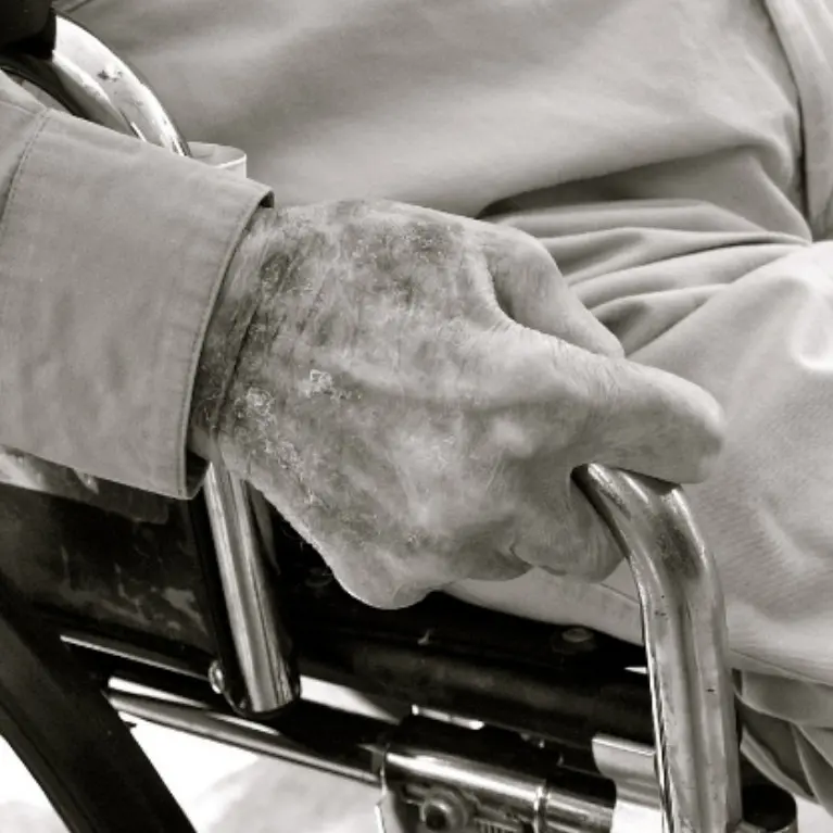 Niente trasporto in ospedale, l’appello di un dializzato di Ricadi: «Abbandonato dalle istituzioni»