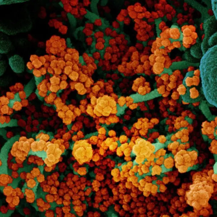 Covid, la variante KP3 causa un picco estivo di casi: ecco come non rovinarsi le vacanze