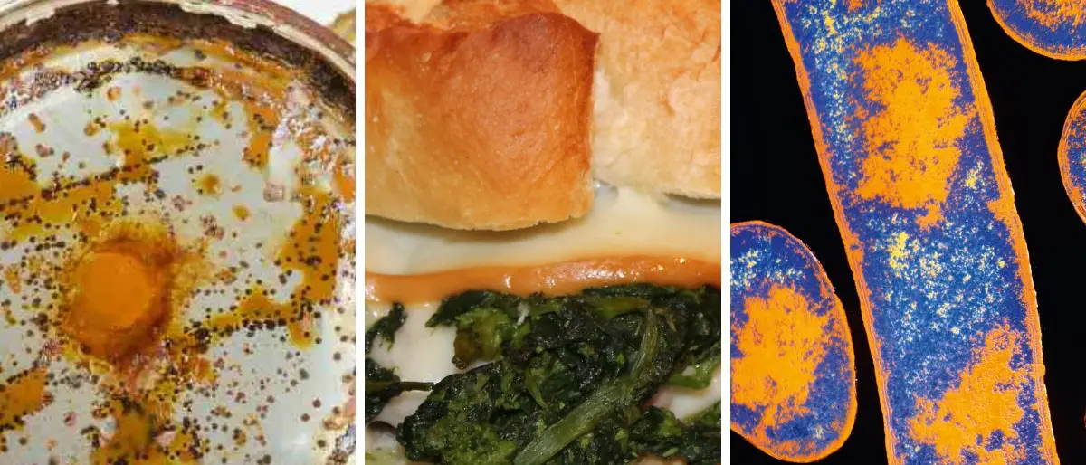 Botulino a Diamante, nuovo ricovero all’Annunziata: ha 20 anni ed è in Terapia Intensiva\n