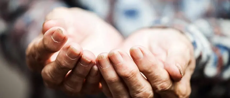 Carità e Covid, monsignor Ramondino: «No a passerelle e patetiche strette di mano»