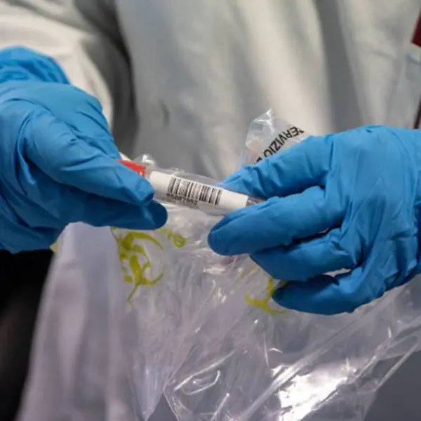 Coronavirus: la nuova ondata nel Vibonese colpisce pure l’ospedale di Tropea