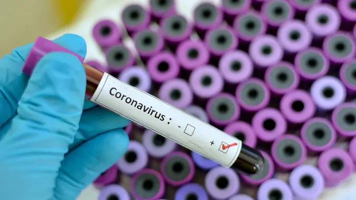 Blood sample with respiratory coronavirus positive , Getty Images/iStockphoto