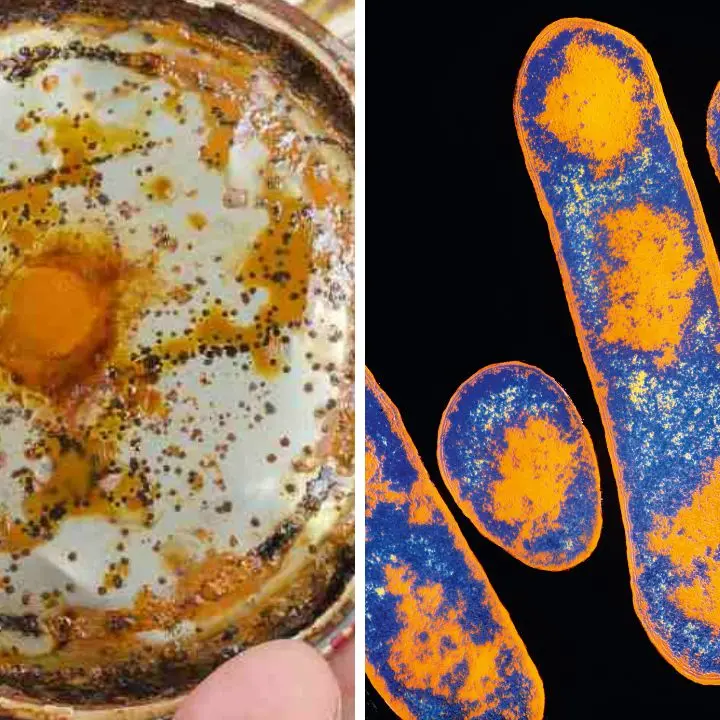 Cibo con botulino a Diamante, l’avvocato del venditore ambulante: «Prodotti mai esposti al sole, erano conservati in frigo»\n
