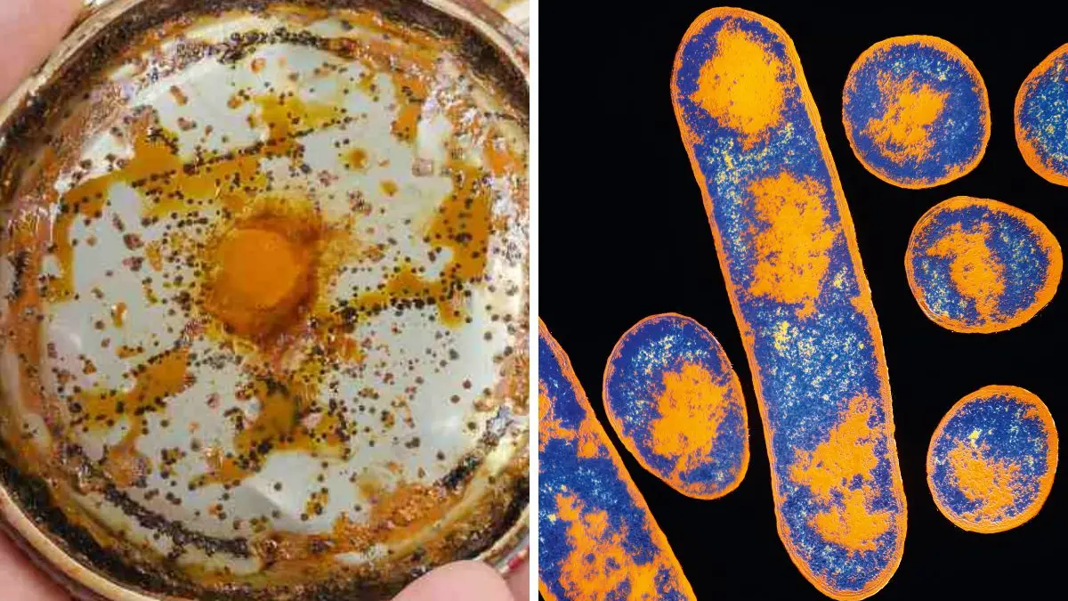 Cibo con botulino a Diamante, l’avvocato del venditore ambulante: «Prodotti mai esposti al sole, erano conservati in frigo»