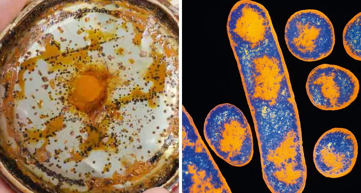 Cibo con botulino a Diamante, l’avvocato del venditore ambulante: «Prodotti mai esposti al sole, erano conservati in frigo»\n