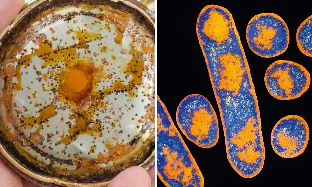 Cibo con botulino a Diamante, l’avvocato del venditore ambulante: «Prodotti mai esposti al sole, erano conservati in frigo»\n