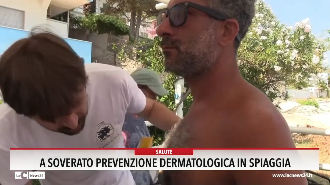 A Soverato prevenzione dermatologica in spiaggia