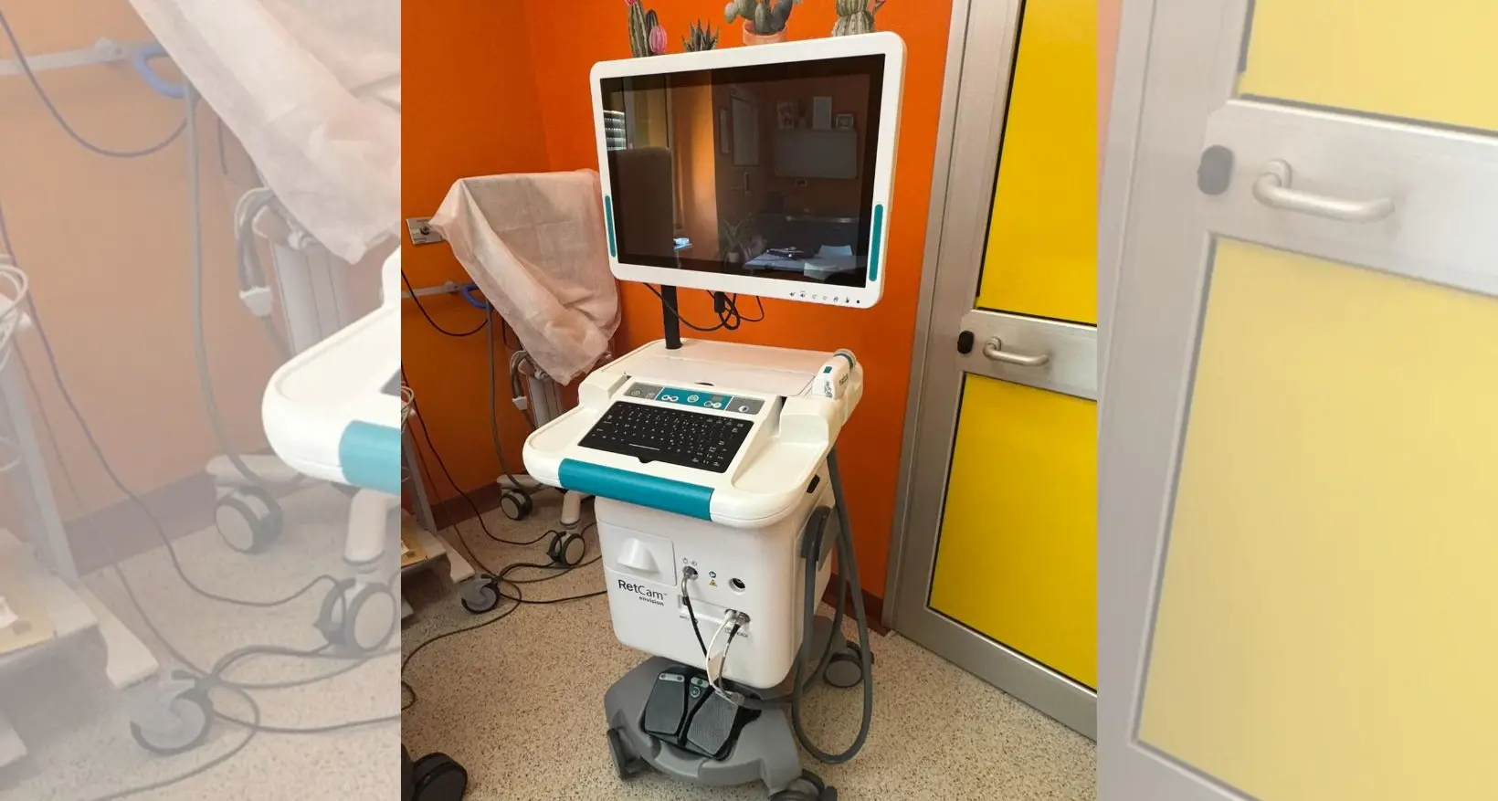 All’Annunziata di Cosenza un’apparecchiatura di ultima generazione per la diagnosi precoce delle retinopatie nei bimbi\n