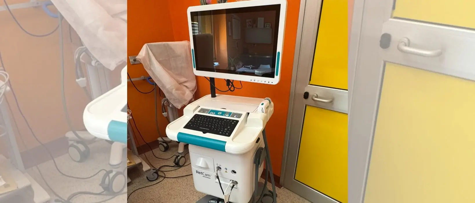 All’Annunziata di Cosenza un’apparecchiatura di ultima generazione per la diagnosi precoce delle retinopatie nei bimbi\n