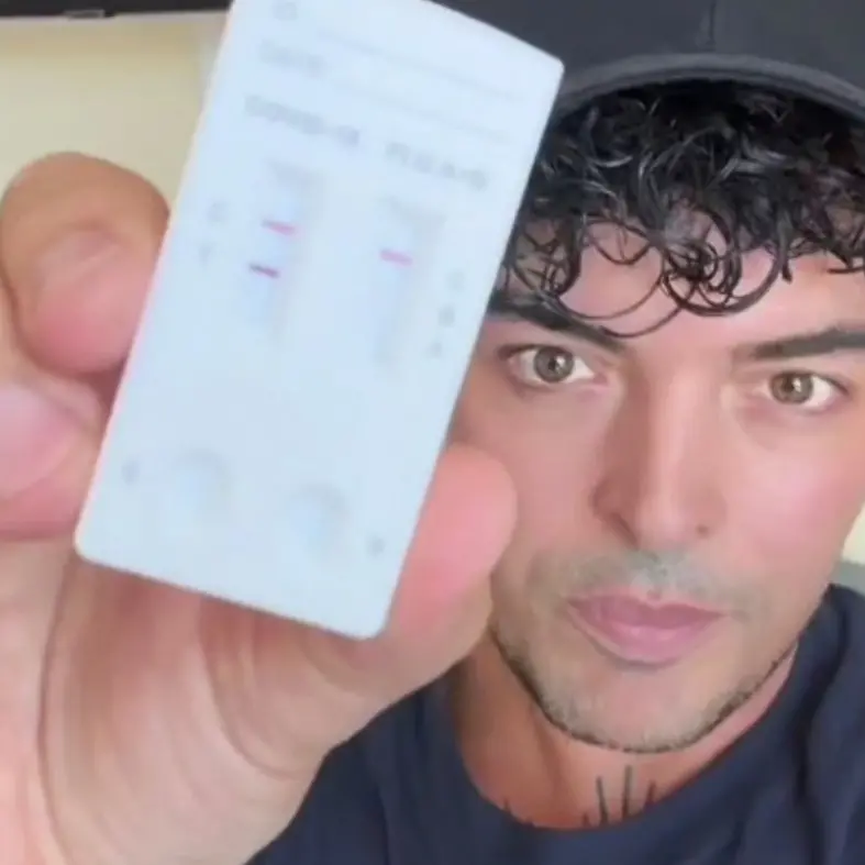 Il cantante Stash, leader dei The Kolors, positivo al Covid: «Non chiamatela influenza, ho rischiato di morire»\n