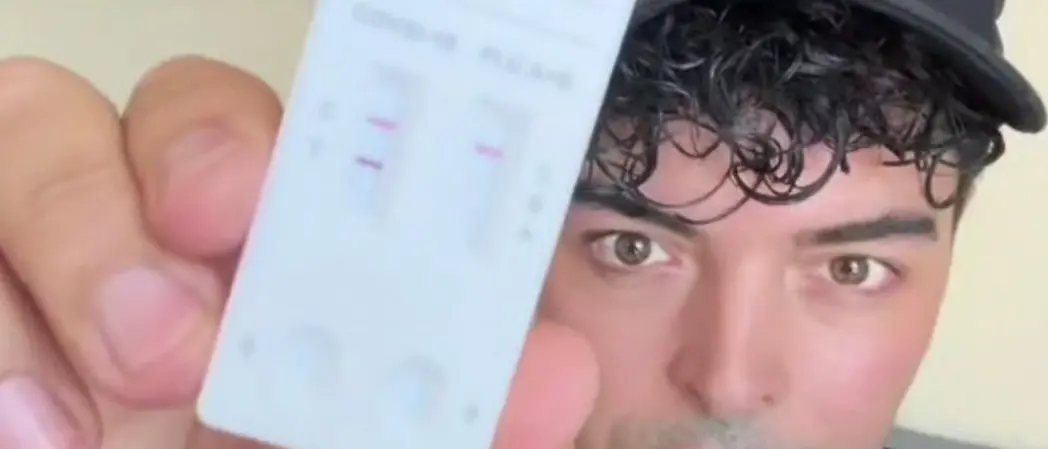 Il cantante Stash, leader dei The Kolors, positivo al Covid: «Non chiamatela influenza, ho rischiato di morire»\n