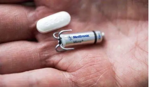 Cosenza, il pacemaker senza fili è realtà: una rete cardiologica che porta innovazione e sicurezza ai pazienti