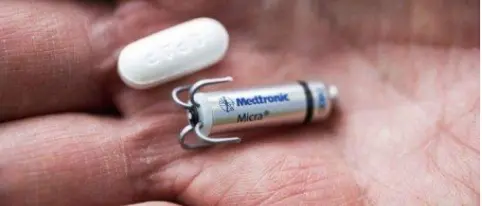 Cosenza, il pacemaker senza fili è realtà: una rete cardiologica che porta innovazione e sicurezza ai pazienti