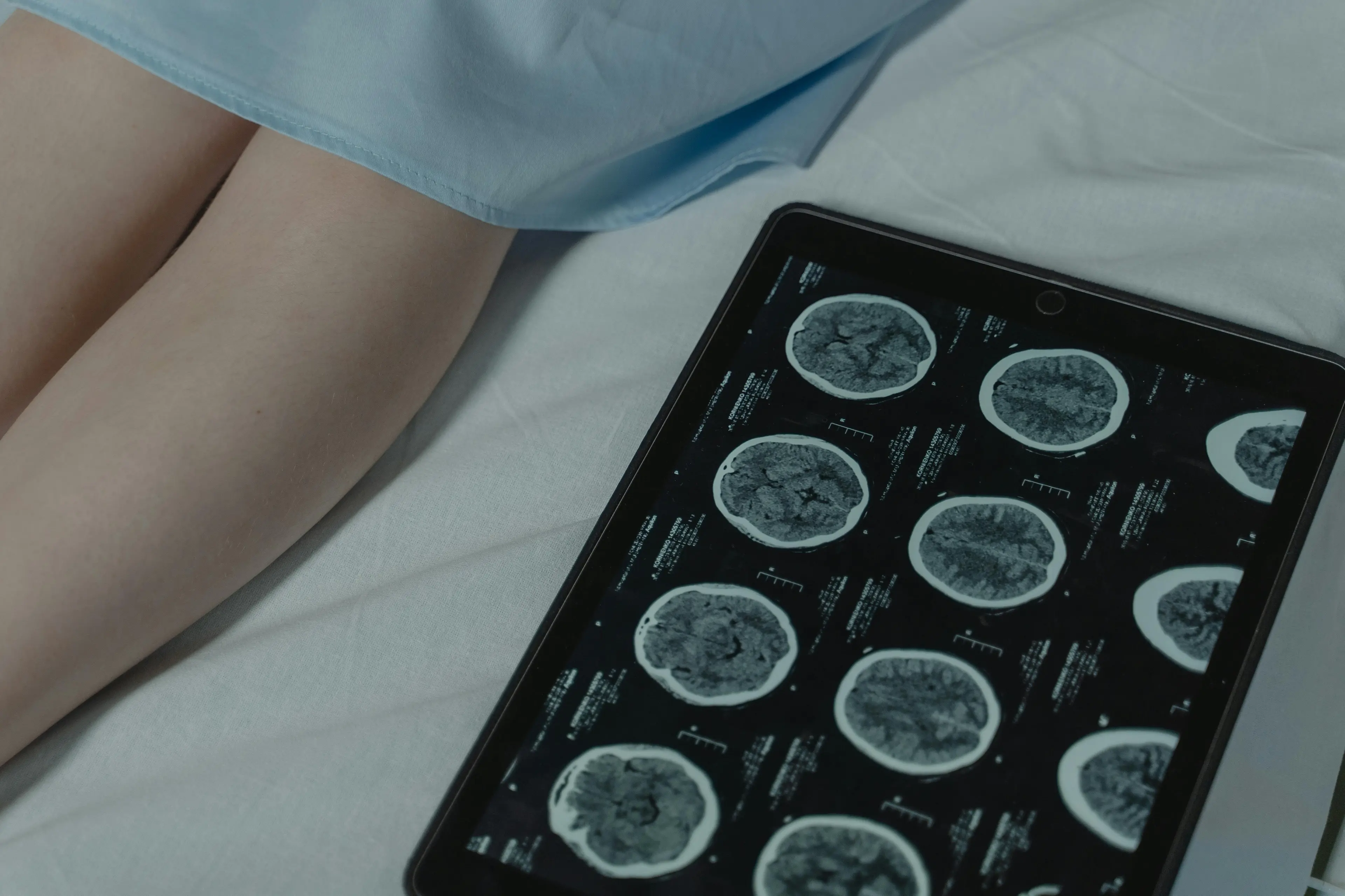 Alla Dulbecco di Catanzaro un nuovo polo multicentrico per la diagnosi e la cura delle malattie neurologiche\n