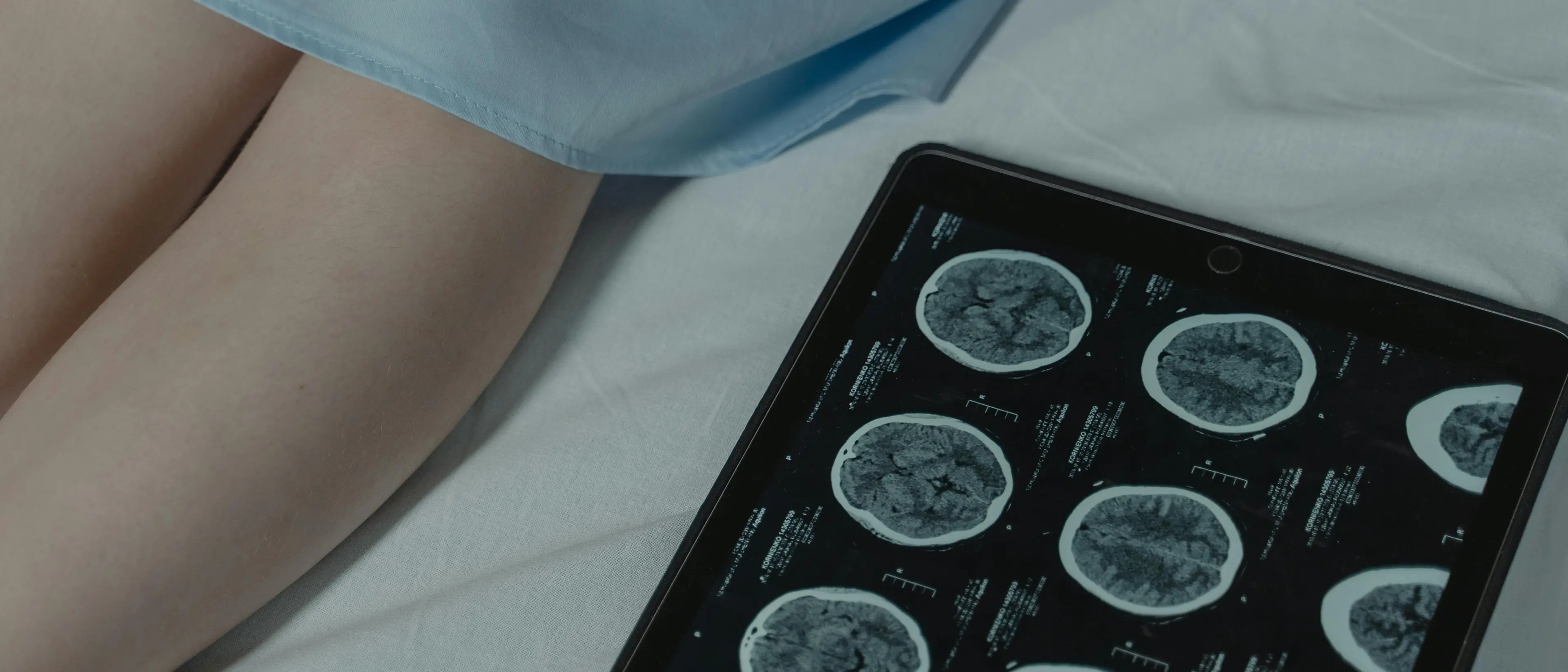 Alla Dulbecco di Catanzaro un nuovo polo multicentrico per la diagnosi e la cura delle malattie neurologiche\n