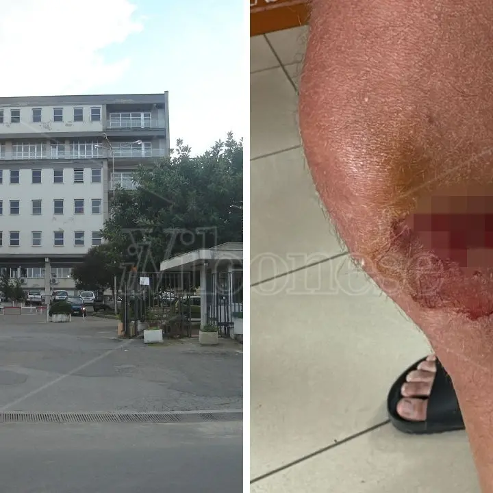 «Al Pronto soccorso di Tropea niente internet, un solo medico in turno e ore di attesa», l'odissea di un paziente che scrive a Occhiuto