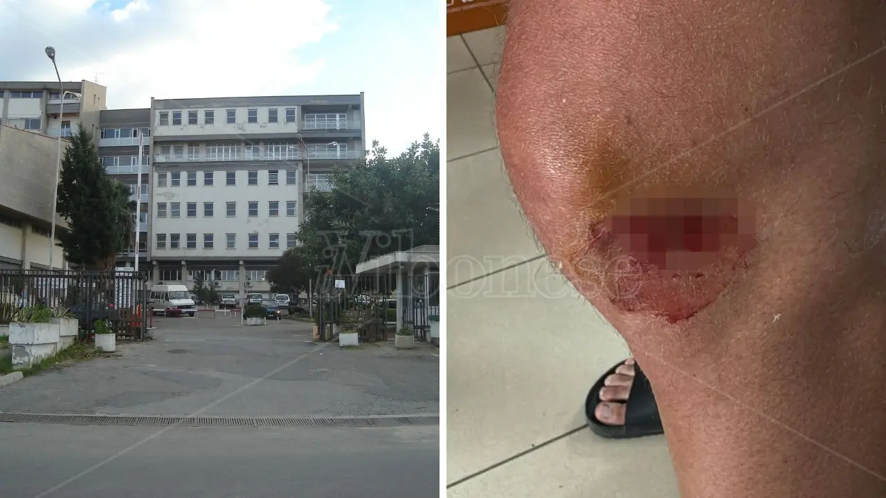 «Al Pronto soccorso di Tropea niente internet, un solo medico in turno e ore di attesa», l'odissea di un paziente che scrive a Occhiuto