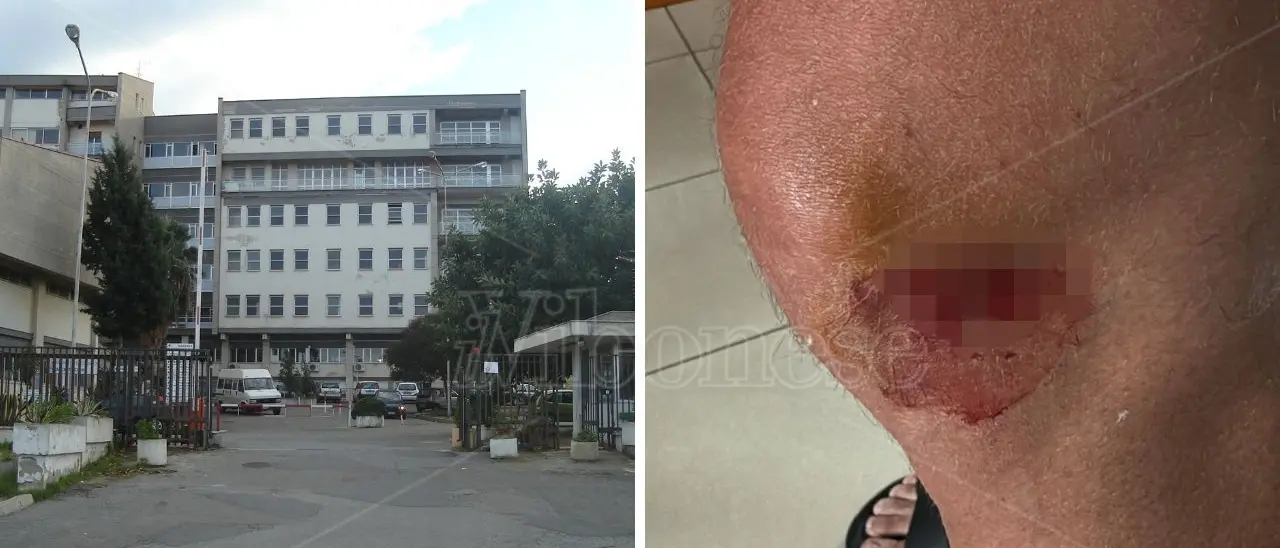 «Al Pronto soccorso di Tropea niente internet, un solo medico in turno e ore di attesa», l'odissea di un paziente che scrive a Occhiuto