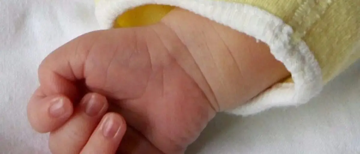 Cosenza, è morto\u00A0il bambino vibonese di 4 mesi trasferito d’urgenza nella Terapia intensiva neonatale dell’Annunziata